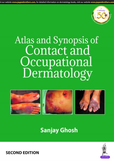 Thumbnail - Atlas and Synopsis of Contact and Occupational Dermatology - 2nd Edition