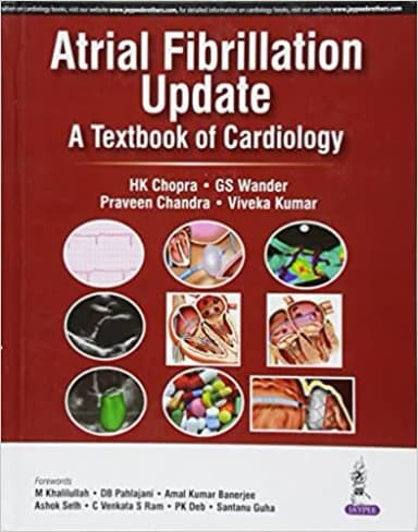 Image of - ATRIAL FIBRILLATION UPDATE A TEXTBOOK OF CARDIOLOGY