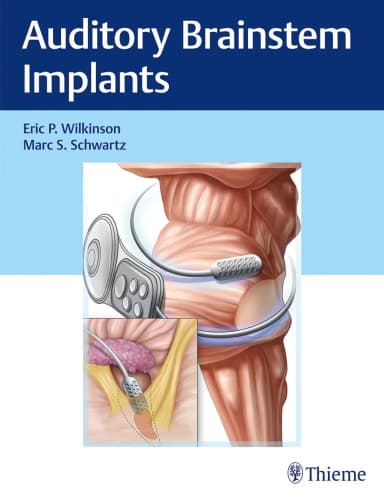 Image of - Auditory Brainstem Implants 1st Ed.