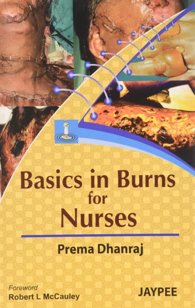 Image of - Basics in Burns for Nurses - 1st Edition