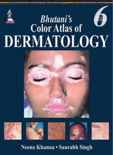 Image of - Bhutanis Color Atlas of Dermatology