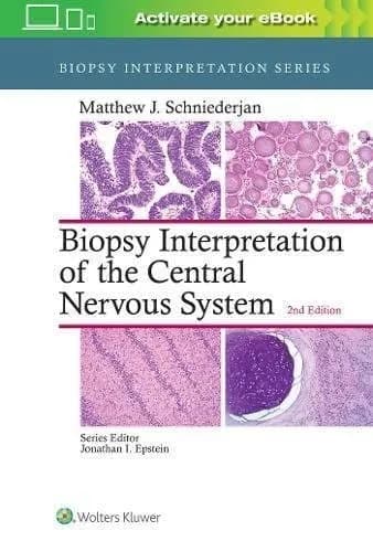 Image of - Biopsy Interpretation of the Central Nervous System -2nd Edition