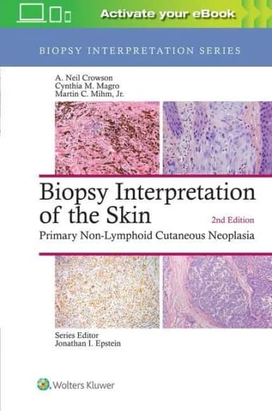 Image of - Biopsy Interpretation of the Skin - 2nd Edition