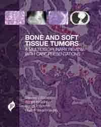 Image of - BONE AND SOFT TISSUE TUMORS:A MULTIDISCIPLINARY REVIEW WITH CASE PRESENTATIONS