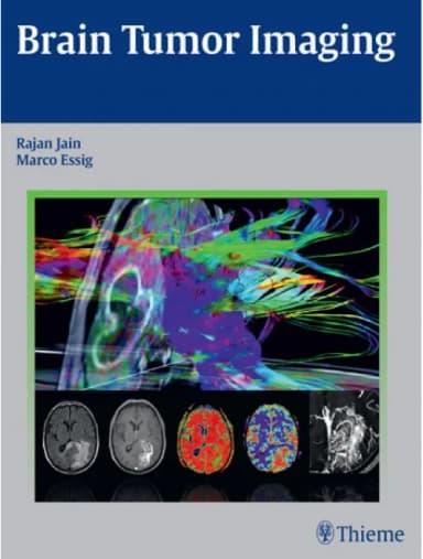 Image of - Brain Tumor Imaging - 1st Edition