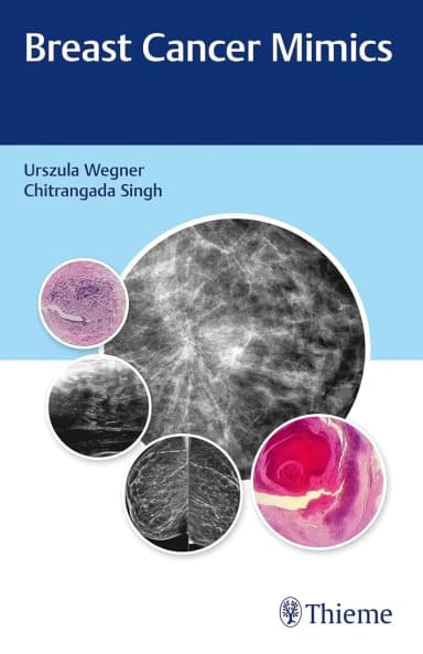 Image of - Breast Cancer Mimics 1st Ed.