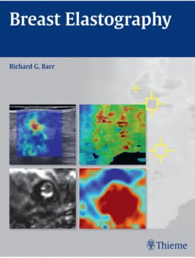 Image of - Breast Elastography - 1st Edition