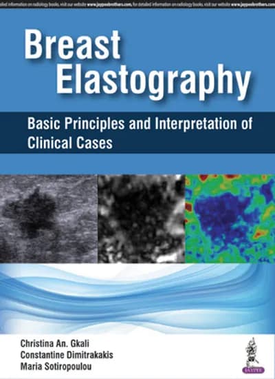 Breast Elastography Basic Principles and Interpretation of Clinical Cases - 1st Edition