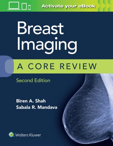 Image of - Breast Imaging : A Core Review - 2nd Edition
