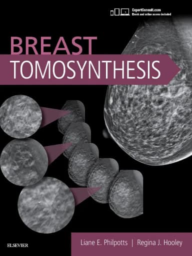 Image of - Breast Tomosynthesis -1E
