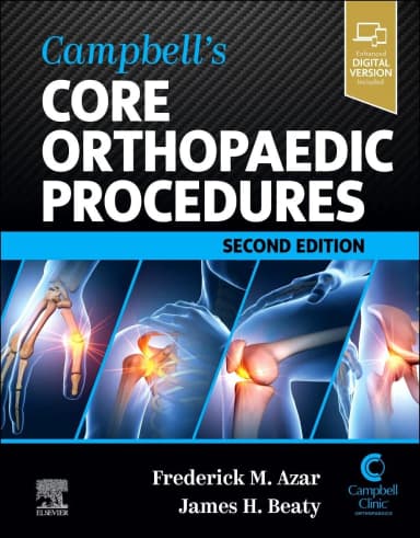 Image of - Campbell's Core Orthopaedic Procedures-2E