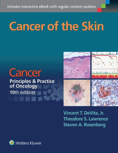 Image of - Cancer of the Skin: Cancer:  Principles and Practice of Oncology - 10th Edition