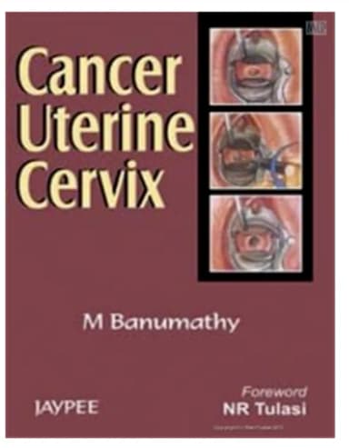 Image of - Cancer Uterine Cervix - 1st Edition