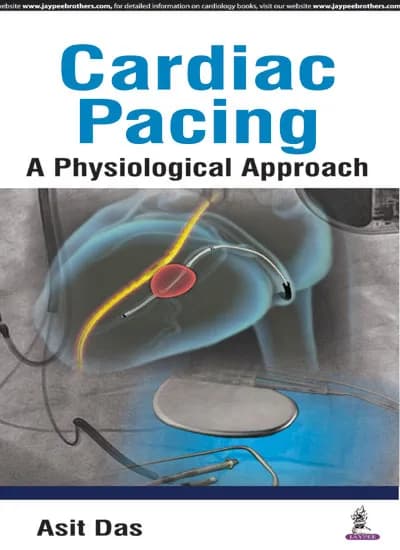 Cardiac Pacing a Physiological Approach - 1st Edition