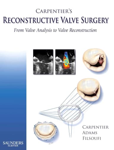 Image of - Carpentier's Reconstructive Valve Surgery