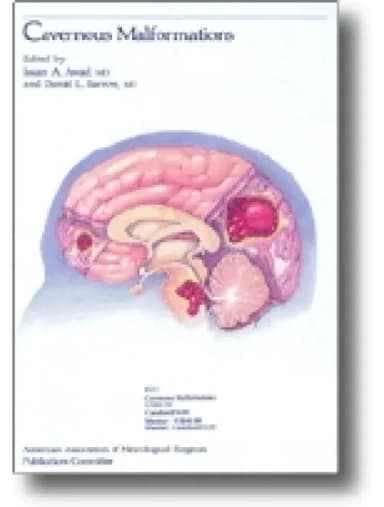 Image of - Cavernous Malformations - 1st Edition