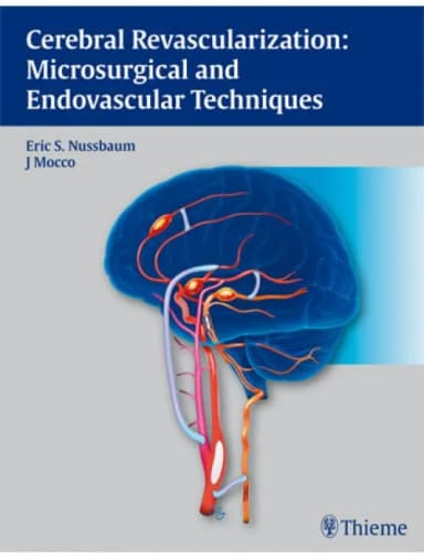 Image of - Cerebral Revascularization Microsurgical and Endov - 1st Edition
