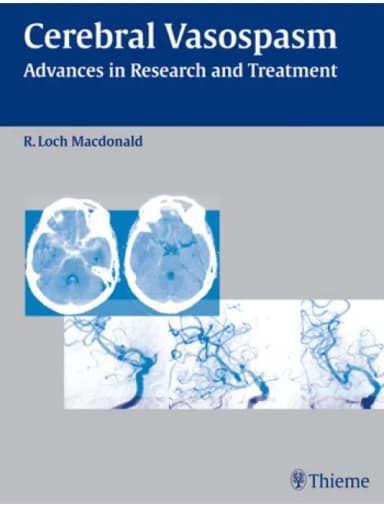 Image of - Cerebral Vasospasm - 1st Edition