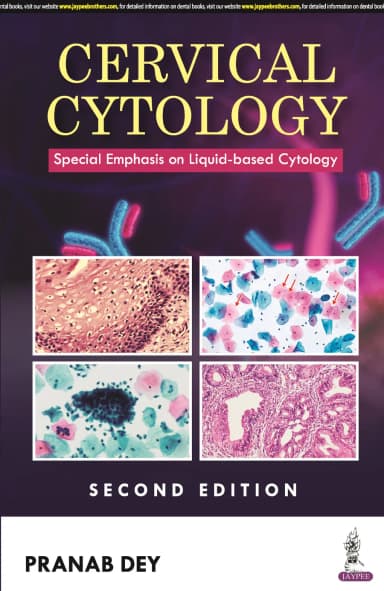 Image of - Cervical Cytology | Special Emphasis on Liquid-based Cytology