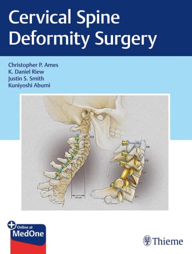 Image of - Cervical Spine Deformity Surgery 1st Ed.
