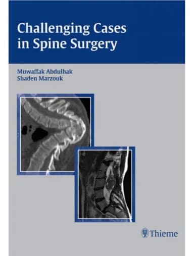 Image of - Challenging Cases in Spine Surgery - 1st Edition