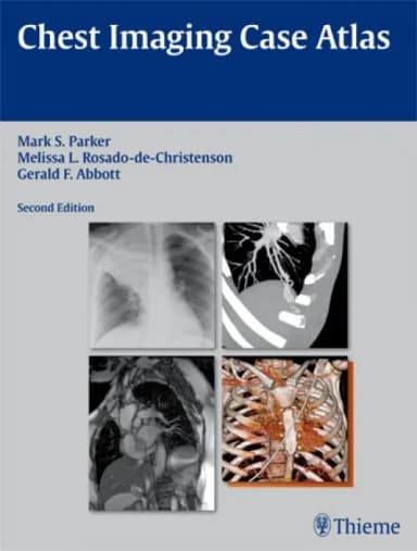Image of - Chest Imaging Case Atlas - 2nd edition
