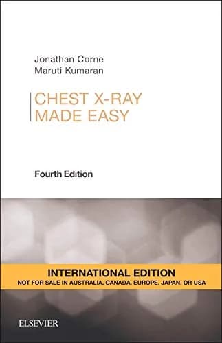 Image of - Chest  X-Ray Made Easy IE - 4E