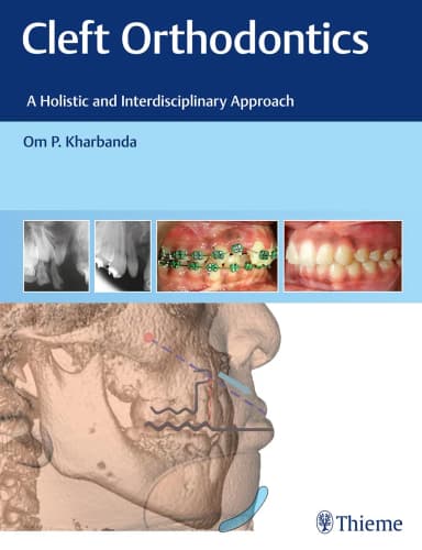 Image of - Cleft Orthodontics 1st Edition