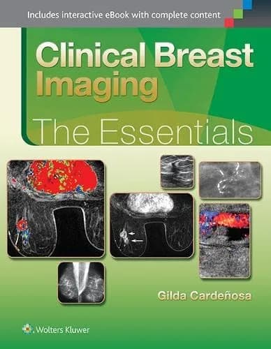 Clinical Breast Imaging  The Essentials - 1st Edition