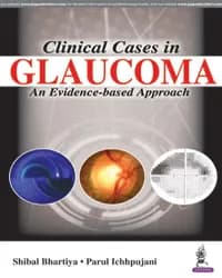 Image of - CLINICAL CASES IN GLAUCOMA AN EVIDENCE-BASED APPROACH
