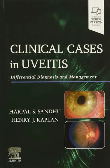 Image of - Clinical Cases in Uveitis-1E