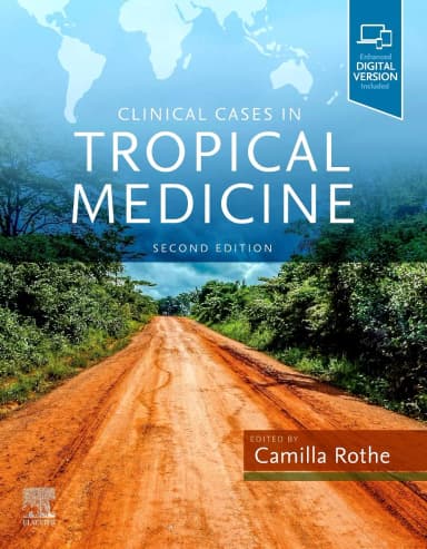 Image of - Clinical Cases in Tropical Medicine- 2nd Edition