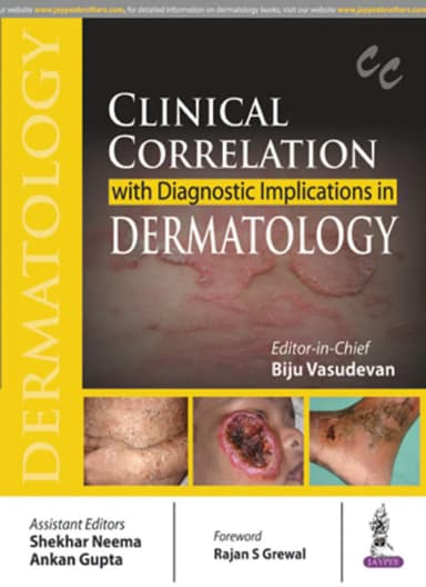 Image of - Clinical Correlation with Diagnostic Implications in Dermatology