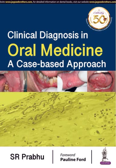 Image of - Clinical Diagnosis in Oral Medicine | A Case-based Approach
