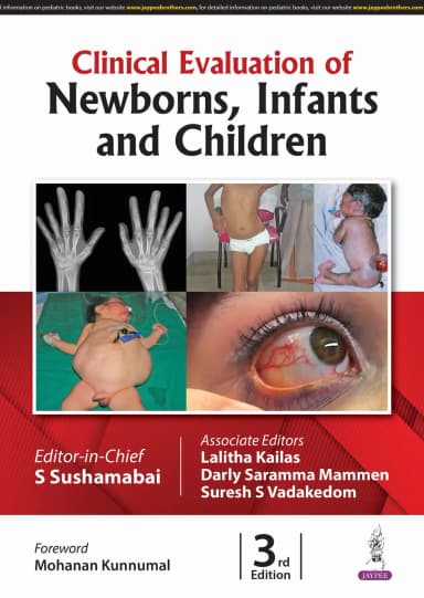 Image of - Clinical Evaluation of Newborns, Infants and Children