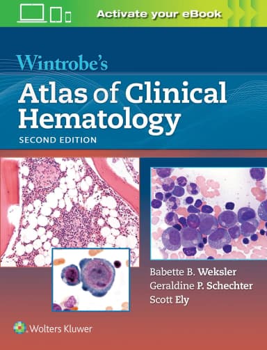 Image of - Wintrobe's Atlas of Clinical Hematology - 2nd Edition