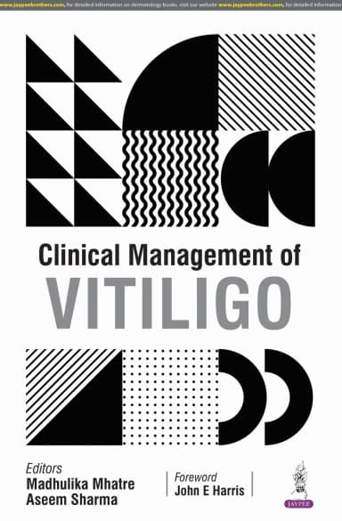 Image of - Clinical Management of Vitiligo