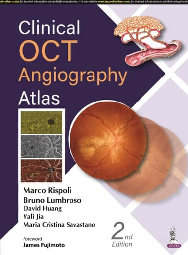 Image of - Clinical OCT Angiography Atlas