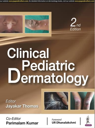 Image of - Clinical Pediatric Dermatology