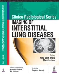 Thumbnail - CLINICO RADIOLOGICAL SERIES:IMAGING OF INTERSTITIAL LUNG DISEASES