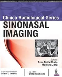 Image of - CLINICO RADIOLOICAL SERIES:SINONASAL IMAGING