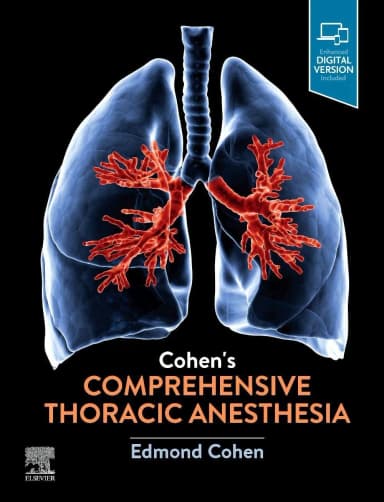 Image of - Cohen's Comprehensive Thoracic Anesthesia - 1E