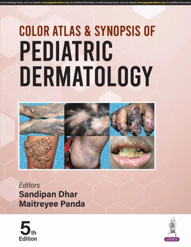 Image of - Color Atlas And Synopsis Of Pediatric Dermatology | 4th Edition