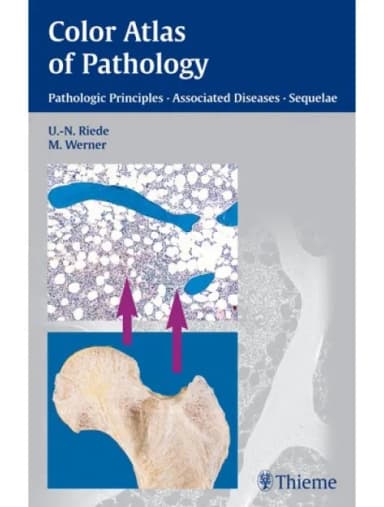Image of - Color Atlas of Pathology - 1st Edition