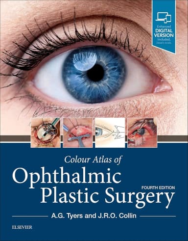 Image of - Colour Atlas of Ophthalmic Plastic Surgery -4E