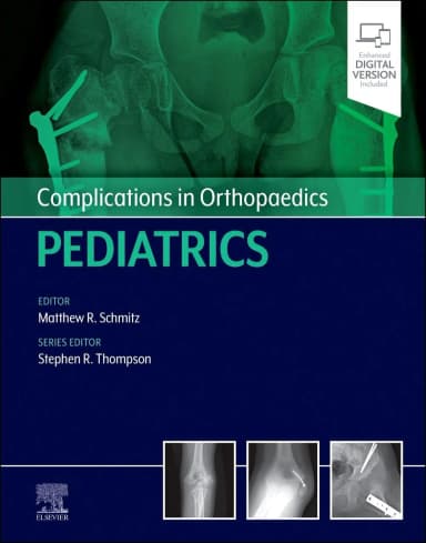 Image of - Complications in Orthopaedics: Pediatrics-1E