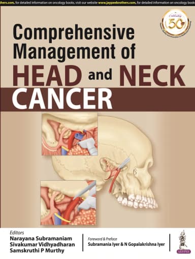 Image of - Comprehensive Management of Head and Neck Cancer