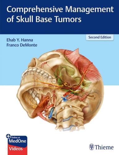 Image of - Comprehensive Management of Skull Base Tumors 2nd Ed.
