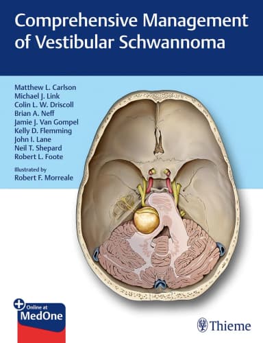 Image of - Comprehensive Management of Vestibular Schwannoma 1st Ed.
