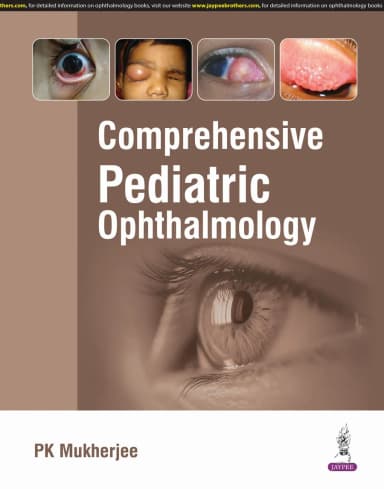 Image of - Comprehensive Pediatric Ophthalmology